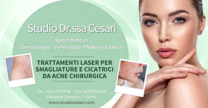 Trattamenti laser per smagliature e cicatrici da acne chirurgica