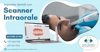 scanner intraorale impronta dentale digitale studio dentistico caddeo