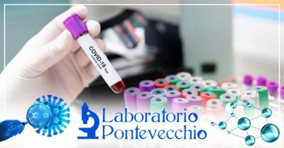  offerta prenotazione test rapido covid 19 bologna test standard quantitativo covid19 bologna