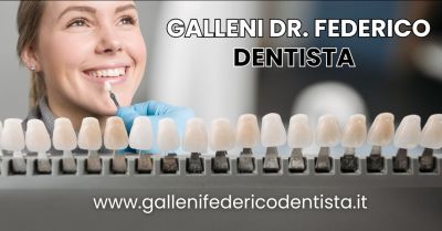 faccette dentali estetiche dentista