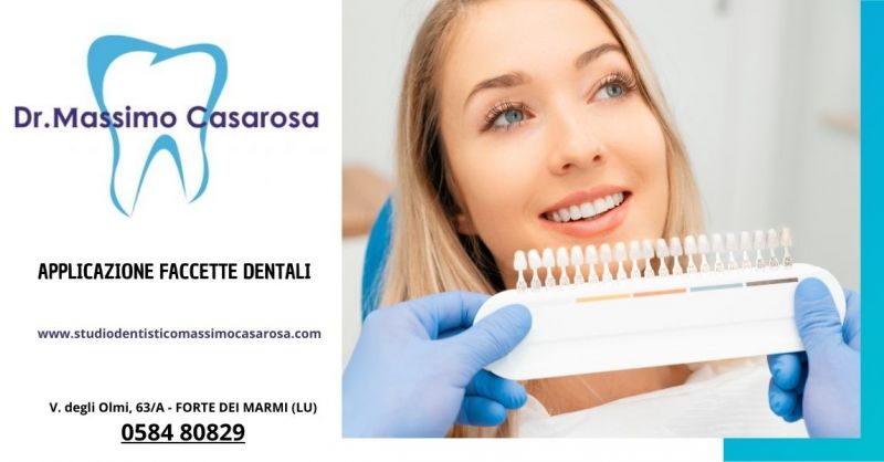 Dentista faccette dentali a Forte dei Marmi