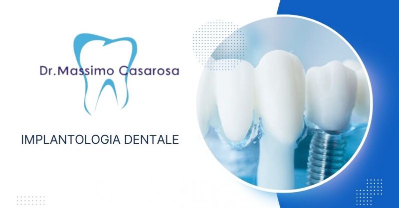 l miglior dentista a Forte dei Marmi