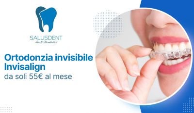 ortodonzia invisibile invisalign