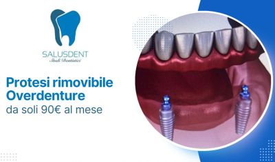 protesi rimovibile overdenture